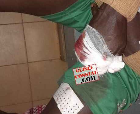 Siguiri : DES BANDITS  ARMÉS ONT OUVERT LE FEU SUR UN  JEUNE DE 28 ANS AU CARREFOUR BAMBA LA.