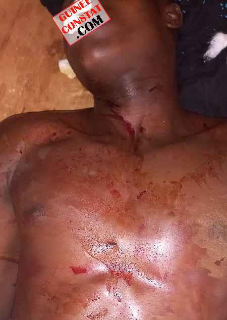Siguiri (kouremale ): POIGNARDÉ DANS LA BOÎTE DE NUIT, LE JEUNE MALAMINE DOUMBOUYA SUCCOMBE FINALEMENT À SES BLESSURES.